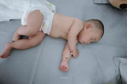 安丘宝宝头上长痱子